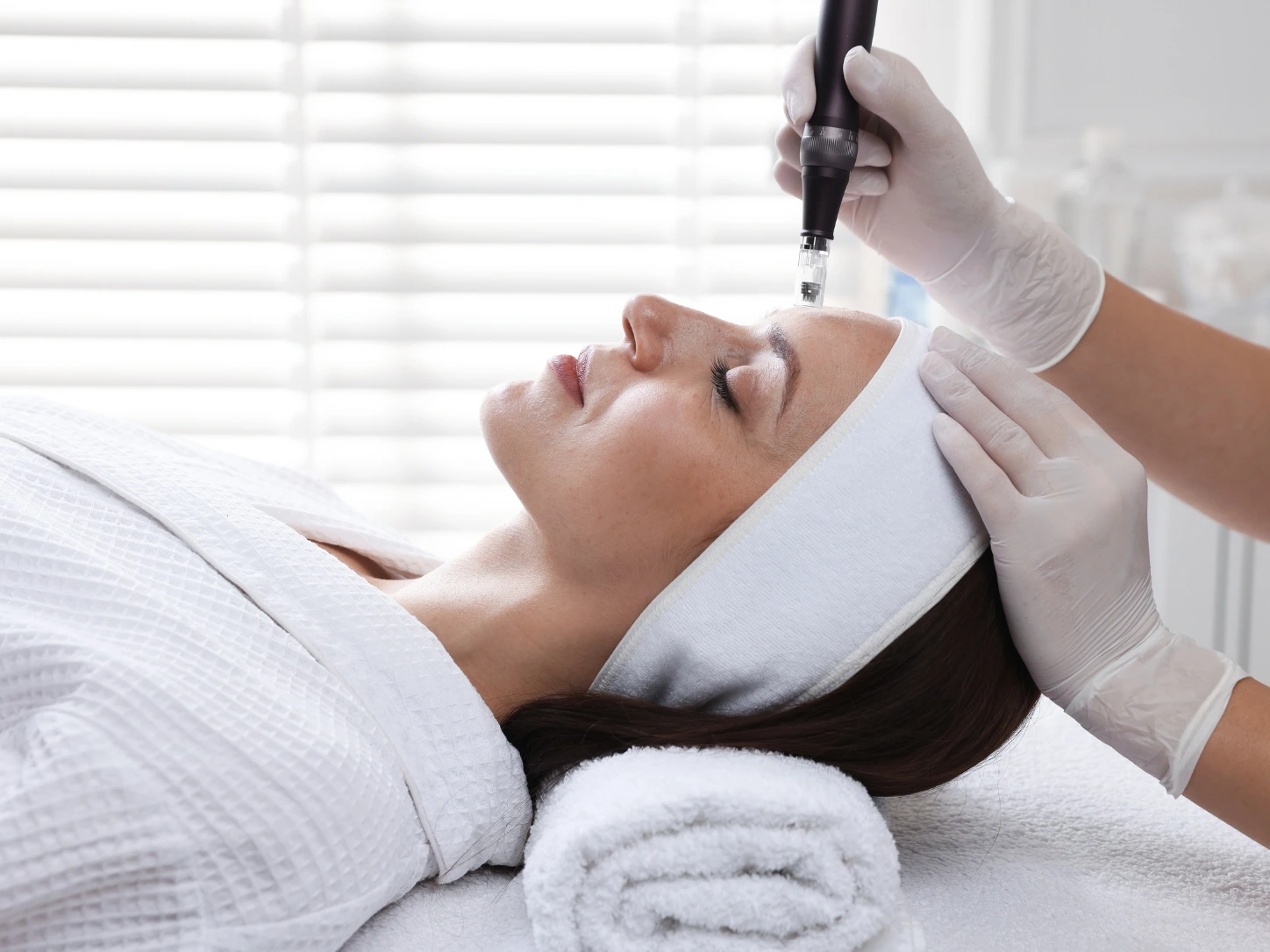 Microneedling treatment at V Hope Medical Center in JLT